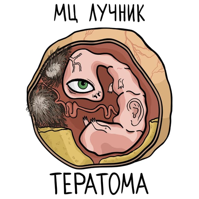 Album cover art for Тератома