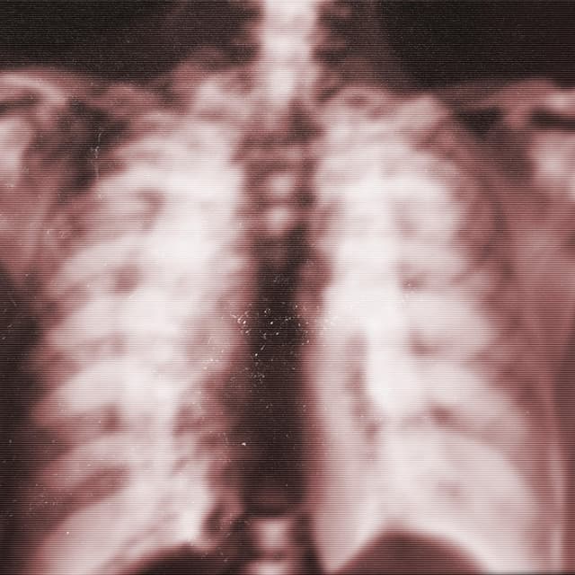 Album cover art for crush