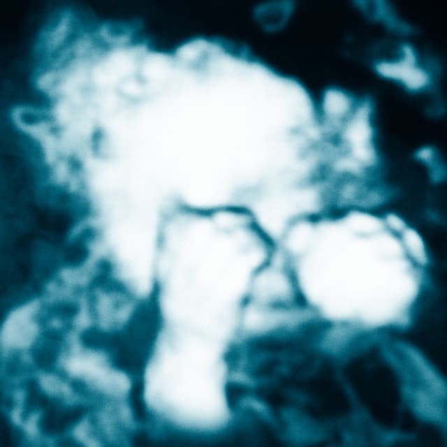 Album cover art for Niño reptil ángel